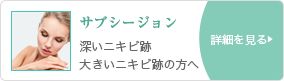 サブシージョン