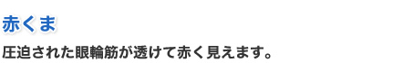 赤くま - 圧迫された眼輪筋が透けて赤く見えます。