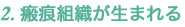 ニキビ跡の原因と仕組み_6