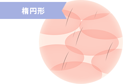 楕円形