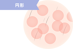 円形