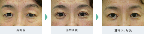 ビフォアーアフター