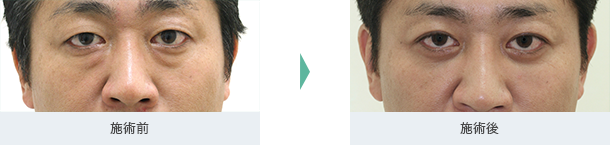 ビフォアーアフター
