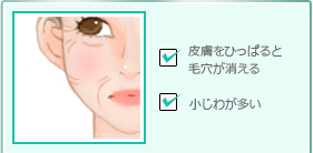 皮膚をひっぱると毛穴が消える小じわが多い