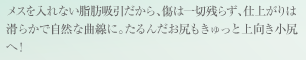 メスを入れない脂肪吸引だから、傷は一切残らず、仕上がりは滑らかで自然な曲線に。たるんだお尻もきゅっと上向き小尻へ！
