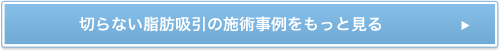 切らない脂肪吸引の施工事例をもっと見る