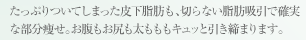 たっぷりついてしまった皮下脂肪も、切らない脂肪吸引で確実な部分痩せ。お腹もお尻も太もももキュッと引き締まります。