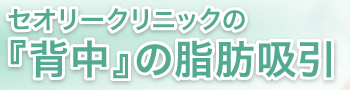 セオリークリニックの『背中』の脂肪吸引