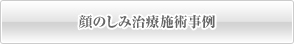 顔のしみ治療施術事例