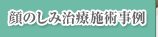 顔のしみ治療施術事例