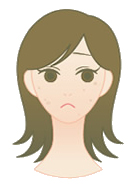 しみ治療