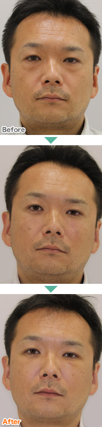 施術事例