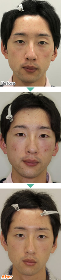 施術事例
