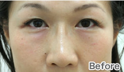 症例写真:Before