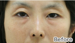 症例写真:Before