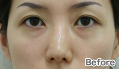 症例写真:Before