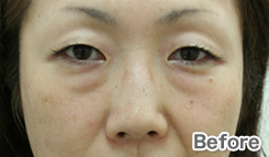 症例写真:Before