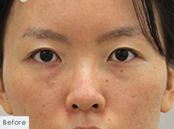 症例写真：Before