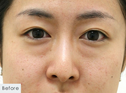 症例写真：Before