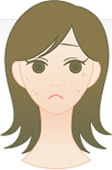 老人性色素斑（日光性のしみ）