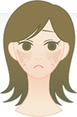 肝斑