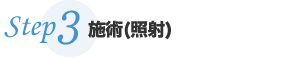 施術(照射)