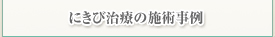 にきび治療の施術事例