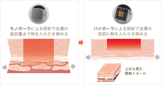 施術前の肌施術後の肌