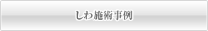 しわ施術事例