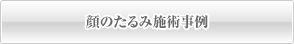 顔のたるみ施術事例