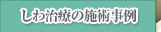 しわ治療の施術事例