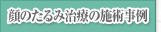 顔のたるみ治療の施術事例
