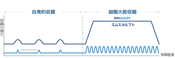 照射イメージ