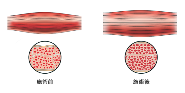 施術前／施術後