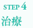STEP4治療