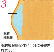脂肪細胞層全体が十分に冷却されます。