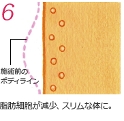 脂肪細胞が減少、スリムな体に。
