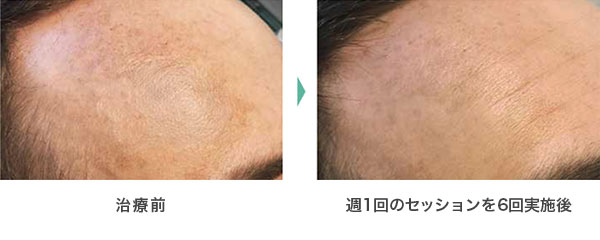 治療事例2