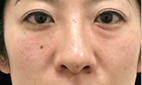 施術前の状態