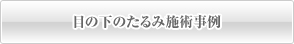 目の下のたるみ施術事例