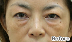 症例写真：Before