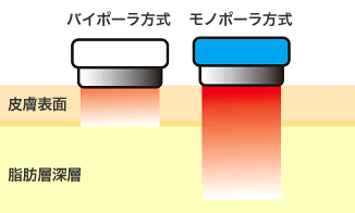 二種類のRF