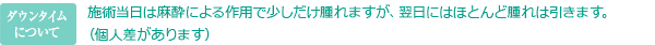ダウンタイムについて