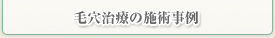 毛穴治療の施術事例