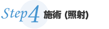 施術(照射)