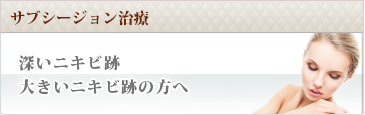サブシージョン治療