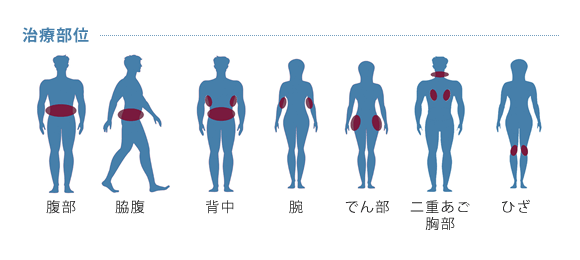 治療部位