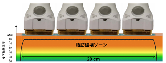 施術時間について
