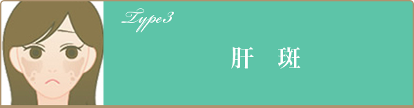 肝斑