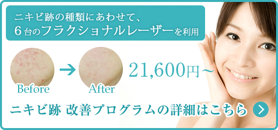 ニキビ跡改善プログラム